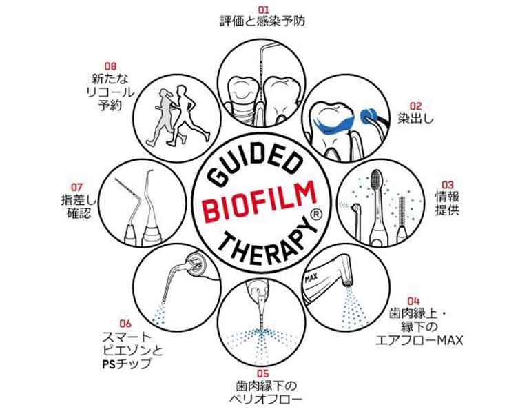 歯の隙間や着色汚れが気になる方